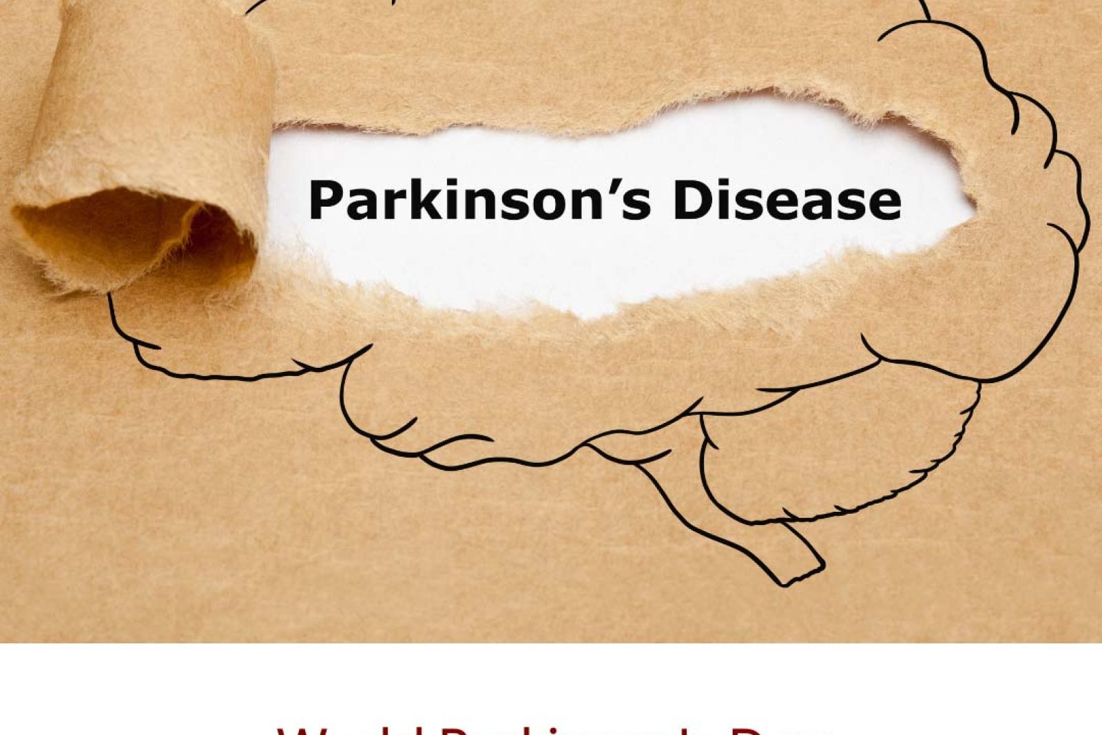 Parkinsons Disease