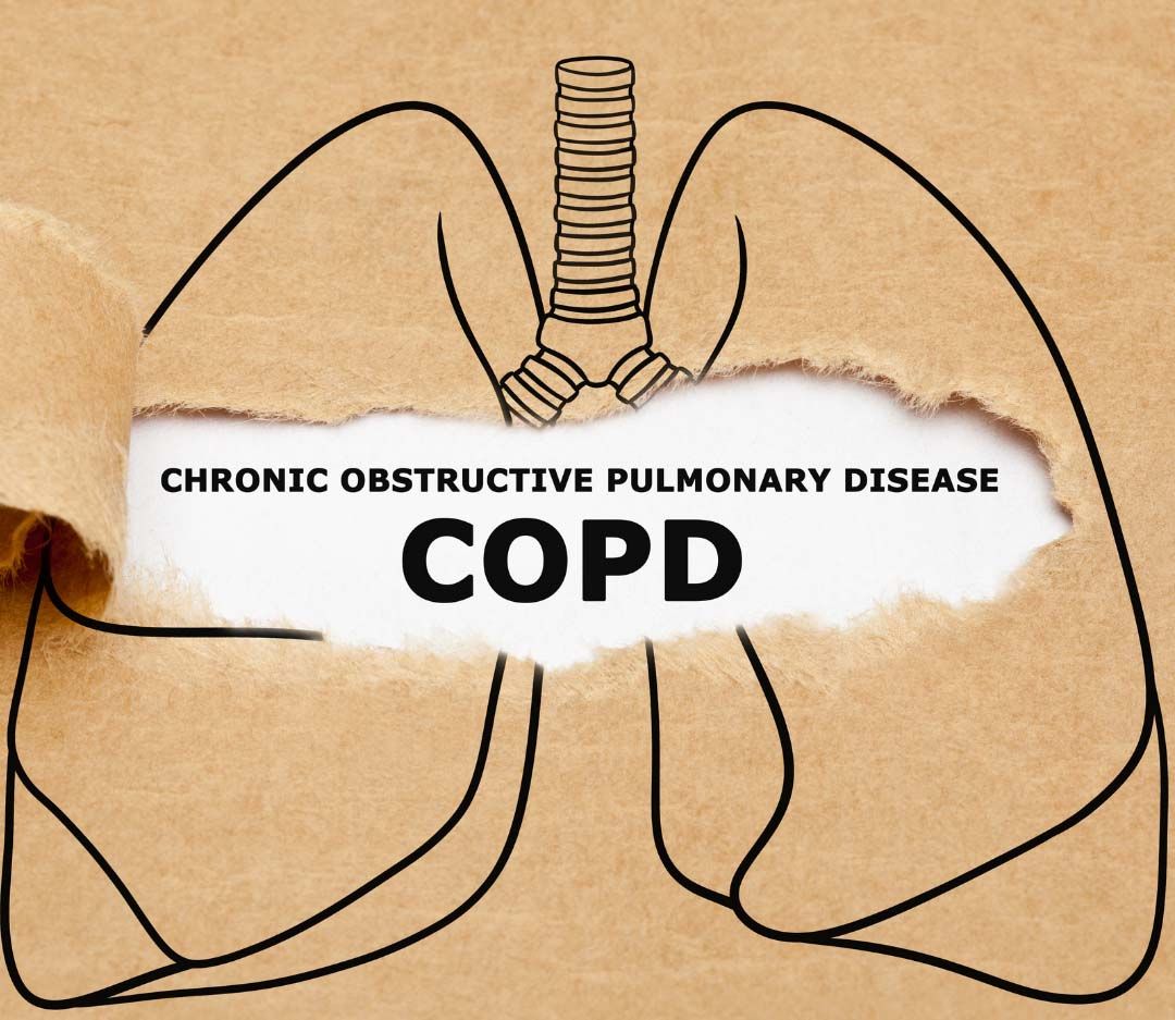 how to live well and breathe well with-COPD-blog