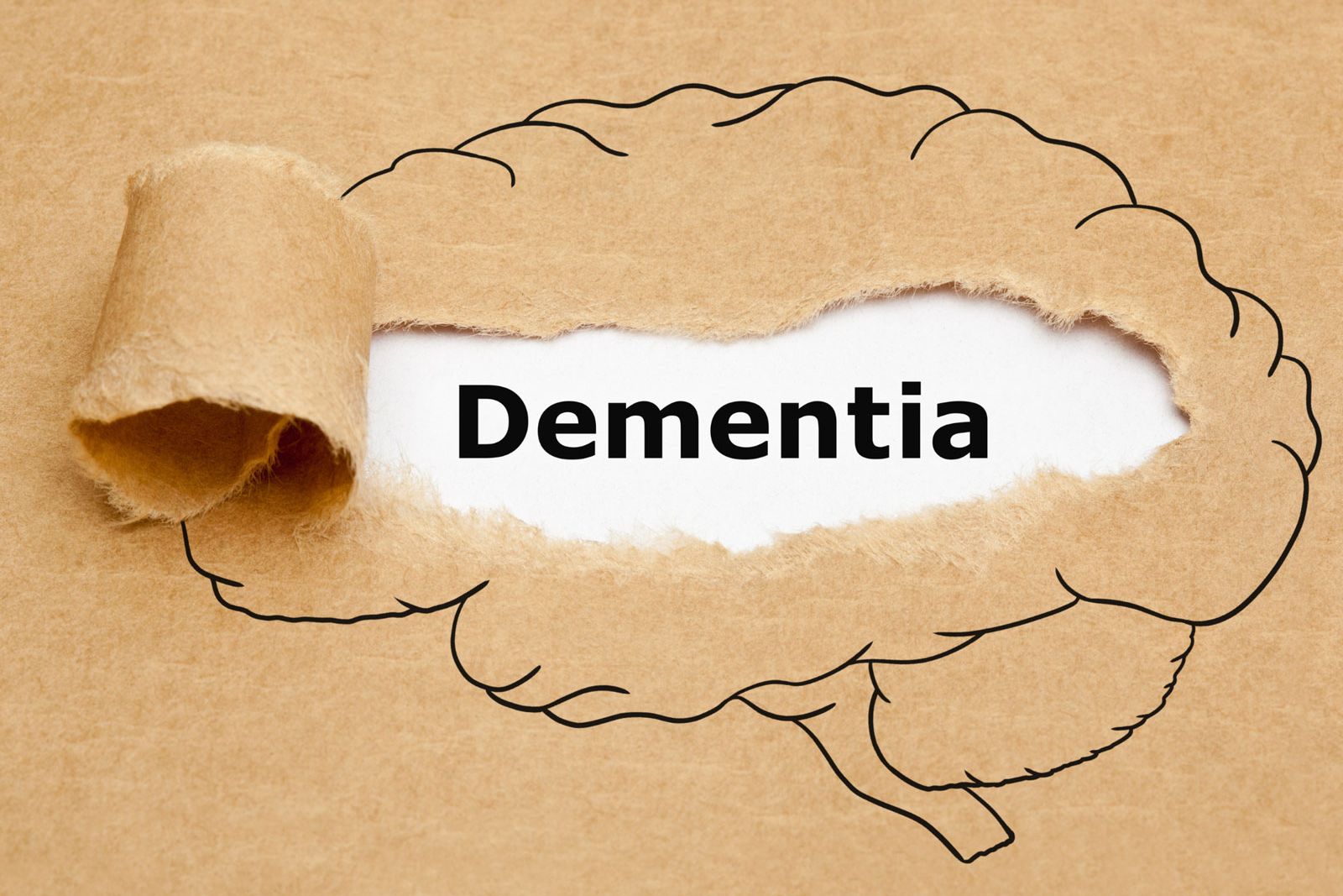 Dos and Don'ts to Defer Dementia